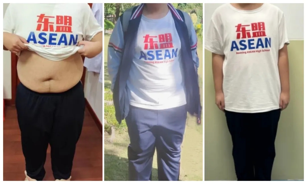 少年逆袭！17岁4个月减重68斤，中医精准减重助他甩掉“青春肥”